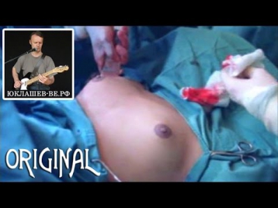 Гермафродиты - ошибка природы. 18+