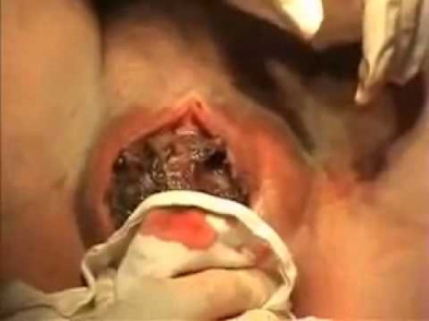 Как рождаются дети birth