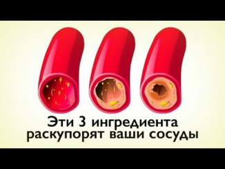 КАК ОЧИСТИТЬ СОСУДЫ С ПОМОЩЬЮ 3-Х ПРОДУКТОВ?