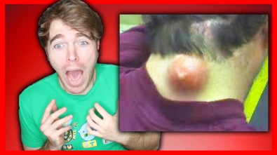 REACTING TO PIMPLE POPPING VIDEOS!