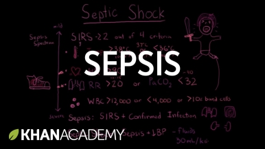 Sepsis: Systemic inflammatory response syndrome (SIRS) to multiple organ dysfunction syndrome (MODS)