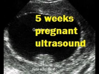 5 hafta homilador ultratovush / 5 həftəlik hamilə ultrasəs / 5 апта жүкті ультрадыбыстық