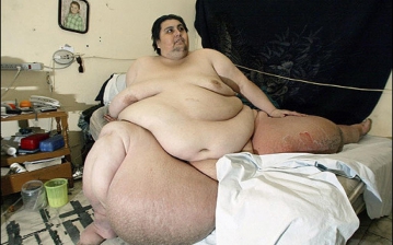 Самый толстый человек в Мире, весит 560 килограм